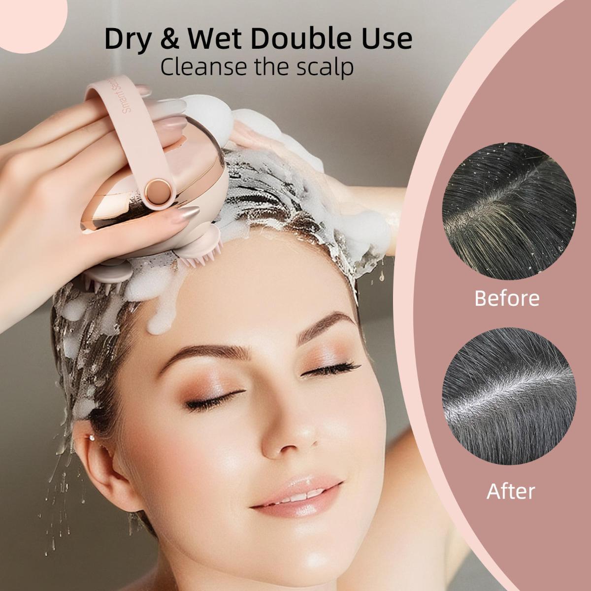 Smart Electric Scalp Massager