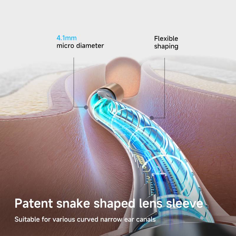 Earsight Plus Ear Wax Removal Tool with Camera by Bebird