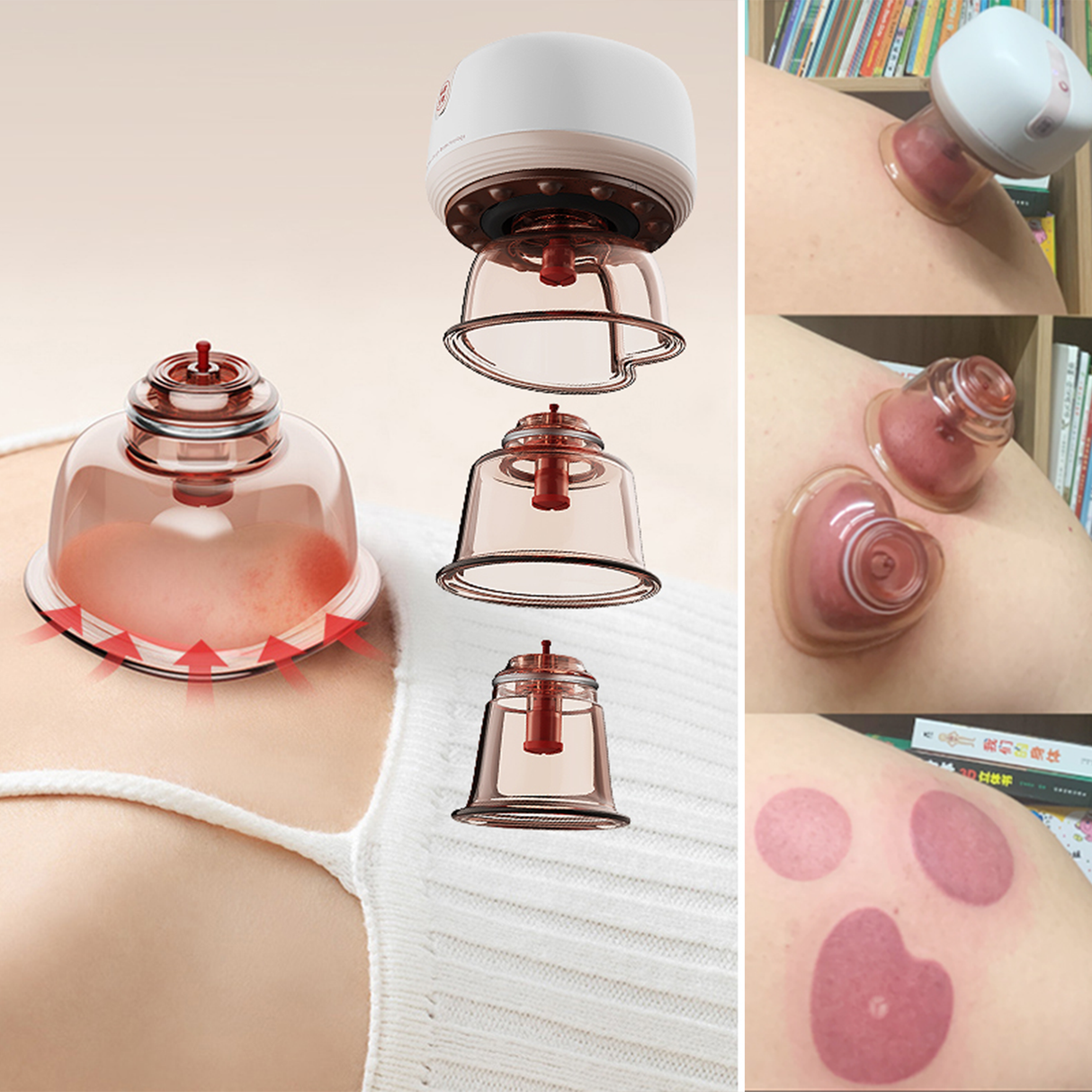 Smart Cupping Therapy Kit Automatic and Manual Set by TechLove